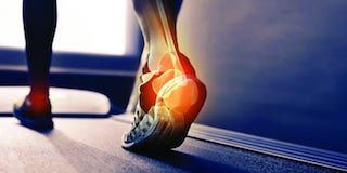 4 Tips Menjaga Kesehatan Tulang