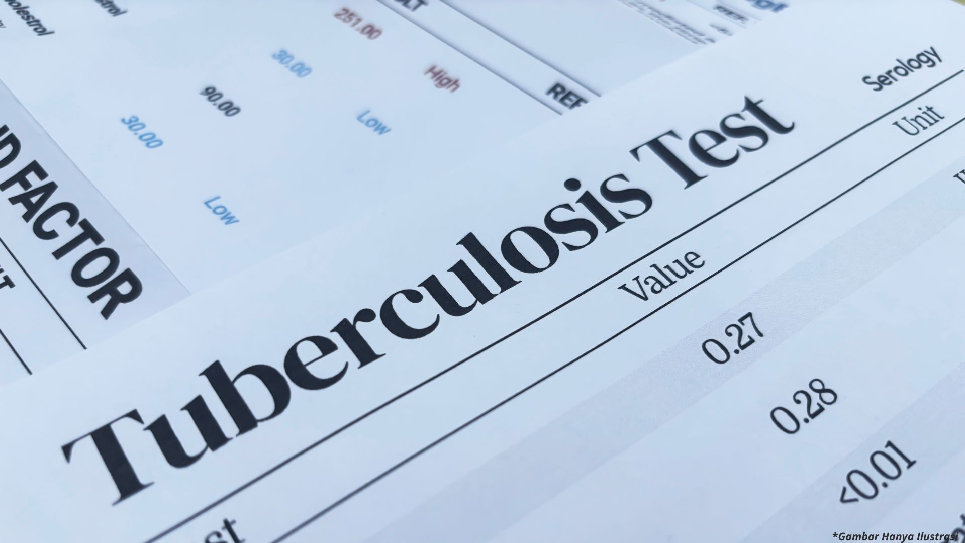 Tangani Kasus TB, Pemkot Cimahi Libatkan Semua Klinik